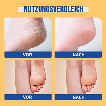 🧴 Feuchtigkeitsspendende Fußcreme – repariert trockene, rissige Haut, pflegt intensiv & sorgt für geschmeidige Füße – ideal für die tägliche Pflege