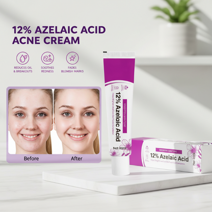 🧴 Aknecreme mit 12 % Azelainsäure – Wirkt gezielt gegen Unreinheiten & Hautrötungen | Sanft, hautverträglich & für empfindliche Haut geeignet – Für ein reineres Hautbild – Jetzt -50%!
