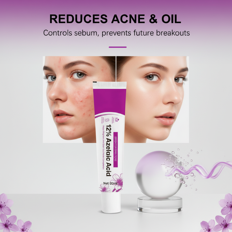 🧴 Aknecreme mit 12 % Azelainsäure – Wirkt gezielt gegen Unreinheiten & Hautrötungen | Sanft, hautverträglich & für empfindliche Haut geeignet – Für ein reineres Hautbild – Jetzt -50%!