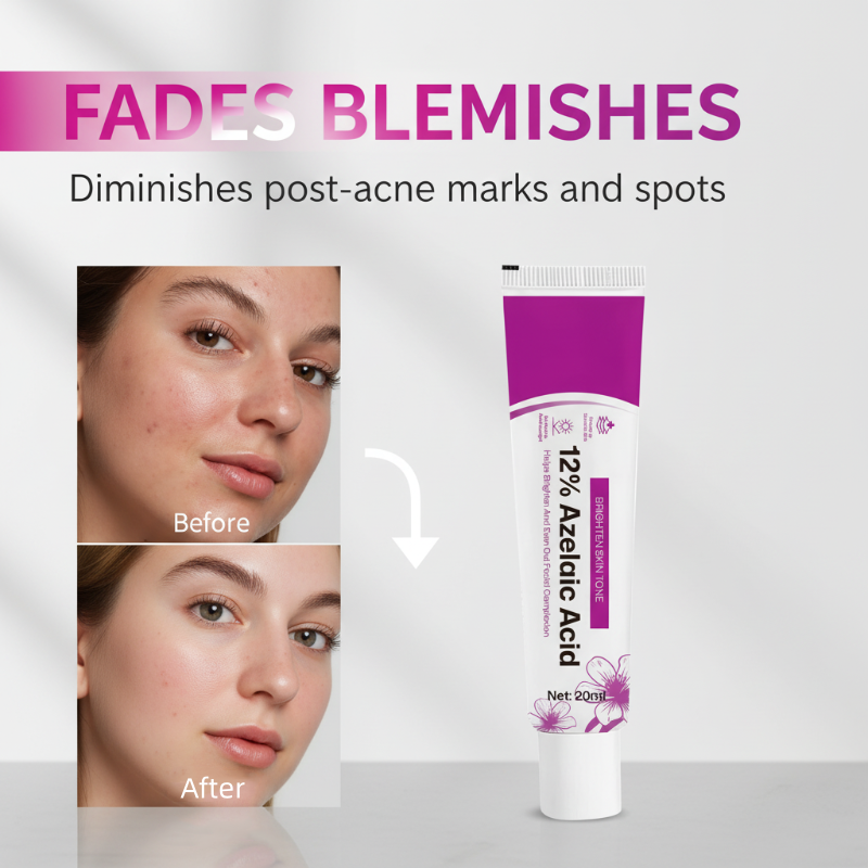 🧴 Aknecreme mit 12 % Azelainsäure – Wirkt gezielt gegen Unreinheiten & Hautrötungen | Sanft, hautverträglich & für empfindliche Haut geeignet – Für ein reineres Hautbild – Jetzt -50%!