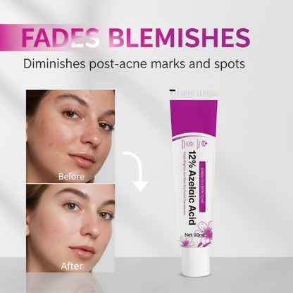 🧴 Aknecreme mit 12 % Azelainsäure – Wirkt gezielt gegen Unreinheiten & Hautrötungen | Sanft, hautverträglich & für empfindliche Haut geeignet – Für ein reineres Hautbild – Jetzt -50%!