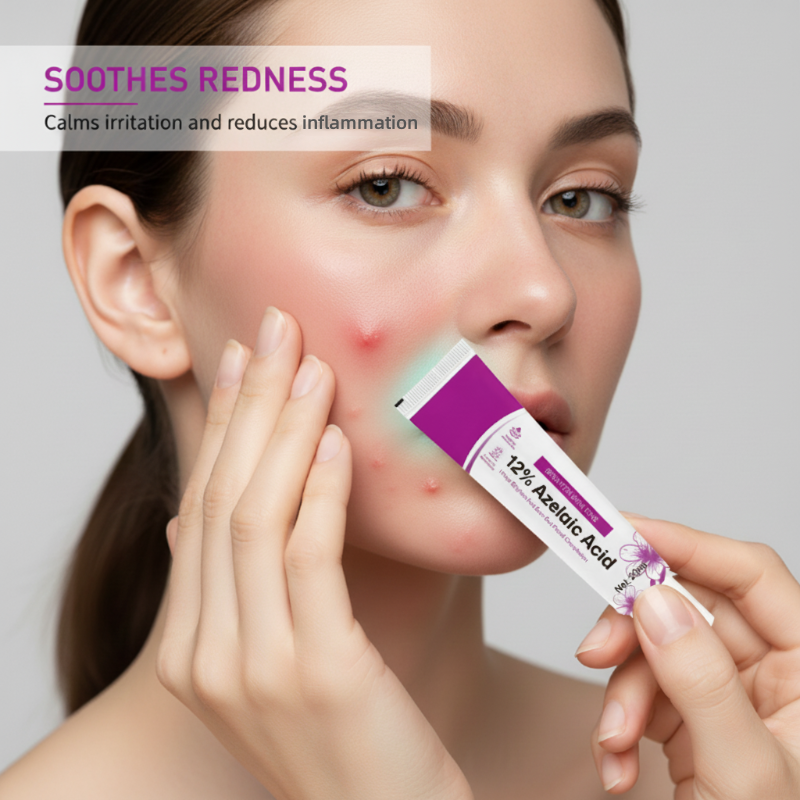 🧴 Aknecreme mit 12 % Azelainsäure – Wirkt gezielt gegen Unreinheiten & Hautrötungen | Sanft, hautverträglich & für empfindliche Haut geeignet – Für ein reineres Hautbild – Jetzt -50%!